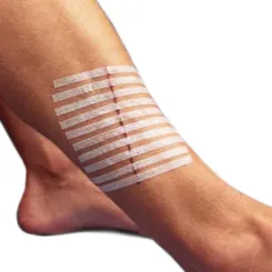 Ponto Falso Skin Strip Sutura 12 Tiras 6,4x76mm Skinupper - Imagem 3